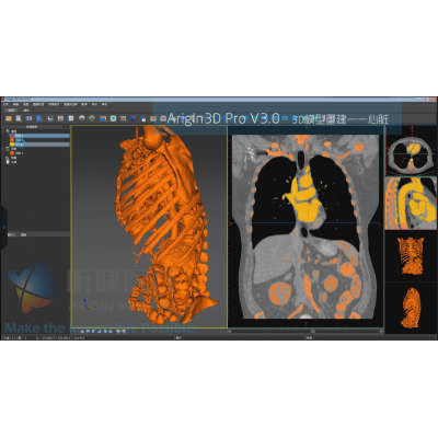 基于Arigin3D Pro V3.0的心脏模型重建